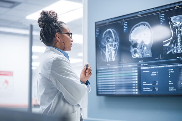 Ärztin betrachtet Gehirnscans auf einem Bildschirm.